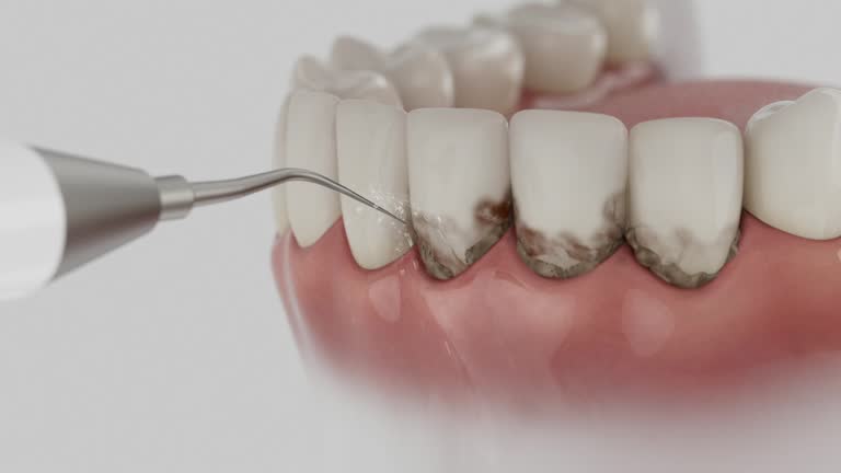 Trusted Dental Crowns And Bridges service in Ivanhoe, TX - Dentist Open Now